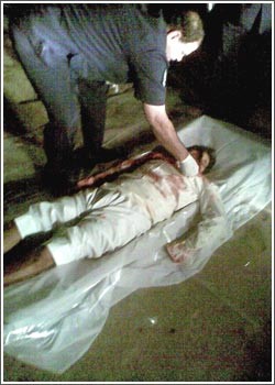 مصرع مواطن اخترق جسده أنبوبان حديديان