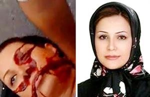صورة ندا اغا سلطان وهي مقتولة والصورة التي رفعت لها خلال المظاهرات ارشيف