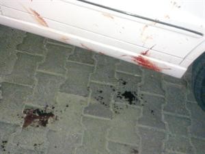 اثار الدماء في موقع الحادث﻿