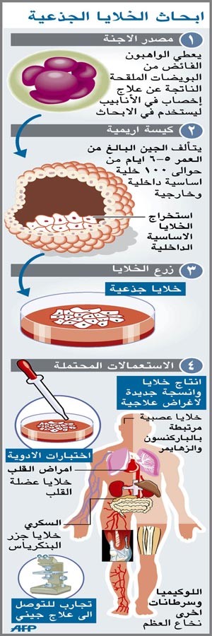 السعودية تمنع تصدير «الخلايا الجذعية» المأخوذة من الحبل السري