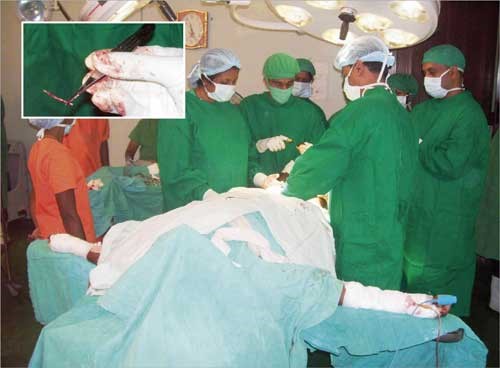 الخادمة السريلانكية المعذبة في غرفة العمليات