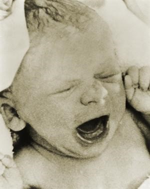 الطفلة لويس براون اول مولودة بتقنية اطفال الانابيب لحظة ولادتها عام 1978	 افپ﻿
