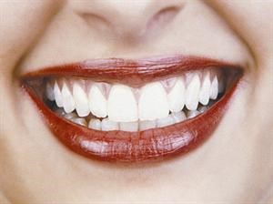 د.عبدالرحمن يكن لـ «الأنباء»: السكاكر والحلويات سبب رئيسي لتسوس أسنان الأطفال