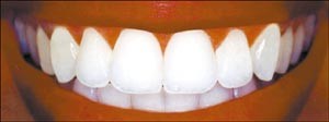 د.عصام الحزامي لـ «الأنباء»: سن الزركونيوم المغلفة بالسيراميك هي الأقرب إلى الأسنان الطبيعية