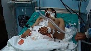 احد جرحى احداث الجمعة في مستشفى درعا 		رويترز﻿