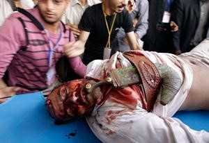 معارضون يمنيون يحملون احد المصابين في مواجهات صنعاء امس	رويترز﻿