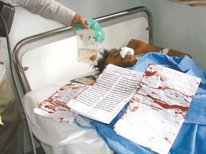  واحد الاطباء يمسك كيسا به اللسان المقطوع﻿