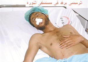  والرميشي متالما﻿