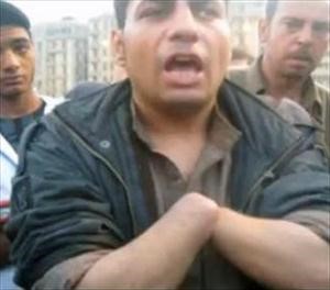 اللص مقطوع اليدين﻿