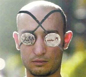 كفيف الثورة.. فقد عينه اليمنى في يناير واليسرى في نوفمبر.. ومعتصمو التحرير يقبضون على ضابط أمن دولة ويفتكون به ومخاوف من موته سريرياً 