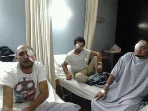 توثيق إصابة 49 حالة في العين لمتظاهري التحرير على أيدي الشرطة