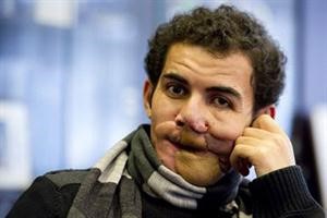 محمد زي﻿