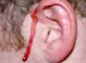 محليون غاضبون يقطعون أذني مشتبه به بعد انفجار قنبلة في أفغانستان