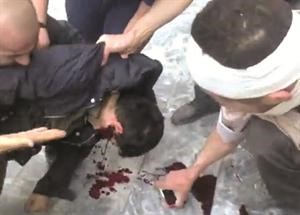 صورة بثها ناشطون لاحد السوريين ينزف بعد اصابته في الراس خلال تشييع جنازة في حلب امس﻿