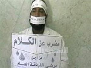طبيب مصري يضرب عن الكلام احتجاجاً على قرار نقله إلى محافظة أخرى