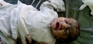 صورة بثها ناشطون لطفل اصيب جراء القصف العنيف على عندان بريف حلب﻿