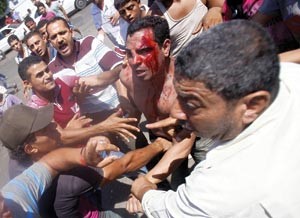 احد مصابي اشتباكات ميدان التحرير بين انصار ومعارضي مرسي رويترز