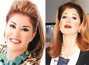 صورة لهالة سرحان قبل وبعد عمليات التجميل﻿