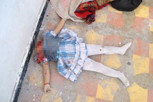 صورة وزعتها شبكة شام لطفلة فقدت راسها في مجزرة كفرعويد في ريف ادلب