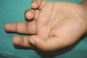 هناك كبسولات لمن يعانون من الام المفاصل﻿
