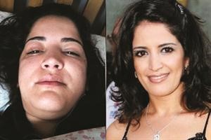 سناء موزيان قبل واثناء الوعكة الصحية