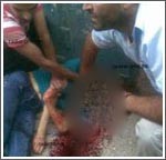 قطع رأس امرأة في أفغانستان