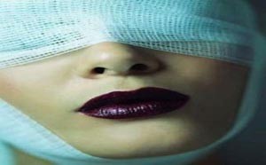 جراحات تجميل مجانية لضحايا العنف المنزلي بأميركا