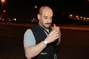 ﻿الزميل هاني الشمري بعد اصابته خلال تغطيته لاحداث امس قاسم باشا﻿