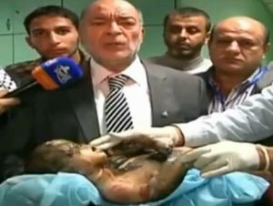 بالفيديو.. اعدام عميل للصهاينة عبر اطلاق النار عليه في غزة.. و مقتل رضيعة فلسطينية يبكي الضمير العالمي
