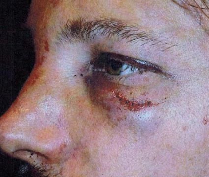 "صور" صادمة لحبيب هالي بيري السابق ..وجنيفر أنيستون تستفز براد بيت من جديد 