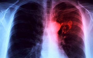 رواج جراحة تجميل الشوارب بالشرق الأوسط.. وعلماء يكشفون عن توليد الكهرباء من نبضات قلب الانسان