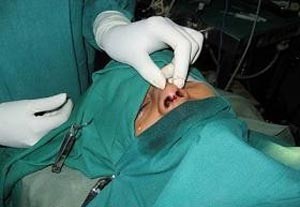 بعد أن قضم أنفها.. زوجة فنان سعودي تعتذر له عن شكواها ضده وتلوم الإعلام 