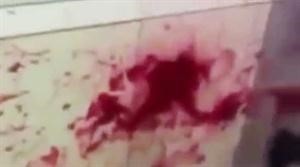 دماء المجني عليه في المجمع