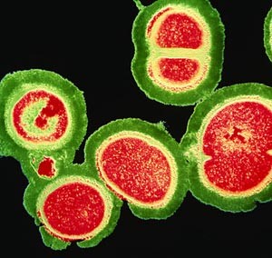 «الصحة» تستنفر لمحاصرة جرثومة  «MRSA» بالمستشفيات وتعد إحصائيات شاملة عن الحالات المصابة