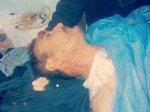 صورة تداولها ناشطون للعقيد رياض الاسعد بعد اصابته ﻿
