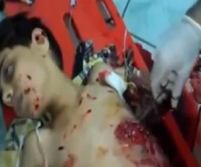  بالفيديو.. مشهد مؤثر لطفل سوري ينطق الشهادة ويتلو القرآن قبل أن تفيض روحه لبارئها 