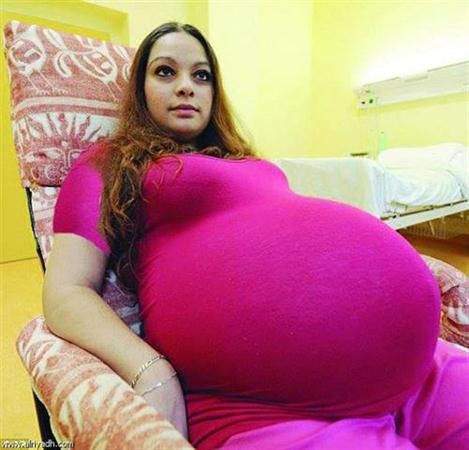 تشيكية تحمل طبيعياً بخمسة توائم لأول مرة في تاريخ بلادها
