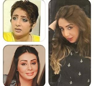 مراحل وجه شيماء علي كما نشرتها على صفحتها في الانستغرام﻿