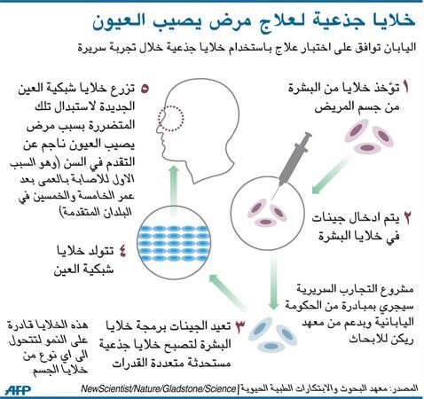 علاج للعمى بالخلايا الجذعية