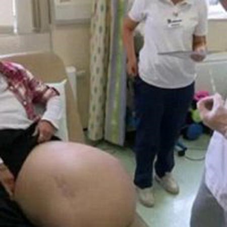 بالصور... امرأة تعـاني من عــدم توقـف نمو قـدميـها
