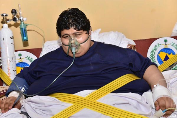 الصحة السعودية : مريض السُّمنة مصاب بداء الفيل وعلاجه يستمر 3 سنوات
