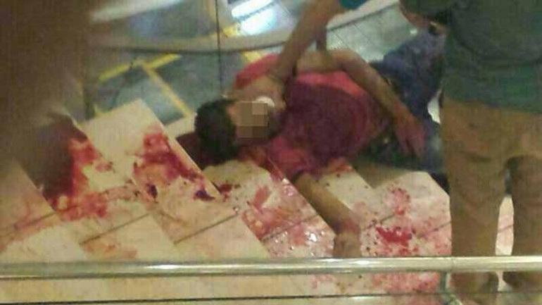 المجني عليه توفي جراء النزيف الحاد