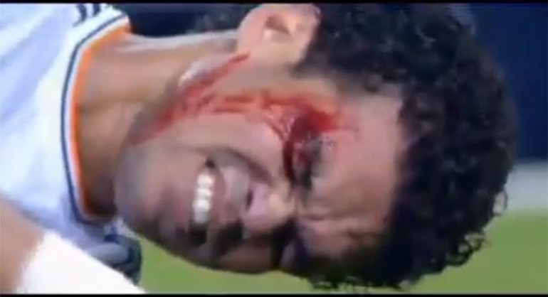 بالفيديو.. بيبي «الفدائي» يغرق في دمائه.. ويرفض ترك الملعب