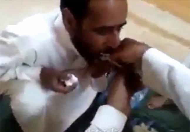 بالفيديو.. سعودي يخلع ضرس صديقه بـ «كماشة»