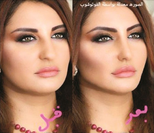 صورة فوتشوب لشذى قبل وبعد عمليات التجميل