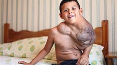 بالفيديو .. طفل يتناول الفياغرا ليبقى على قيد الحياة