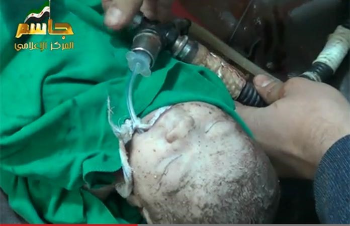 فيديو مروِّع.. صواريخ النظام السوري تُخرج جنيناً «حياً» من بطن أمه!