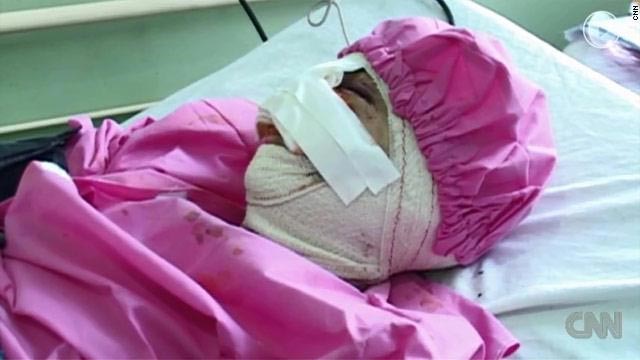 يجدع أنف وشفتي زوجته عقابا لها