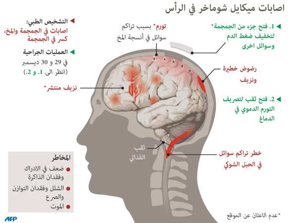 غرافيك يوضح اصابات في راس ميكايل شوماخر من اثر الاصطدام القوي
