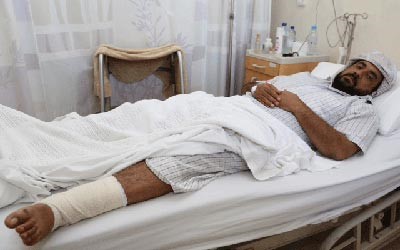 اماراتي طريح الفراش بعد عضة ذئب